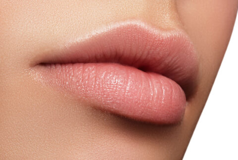 Lip Augmentation